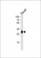 HLA-DQB1 Antibody (N-term)